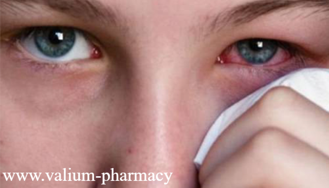5 Jenis Penyakit Mata dan Gejala yang Di Timbulkan
